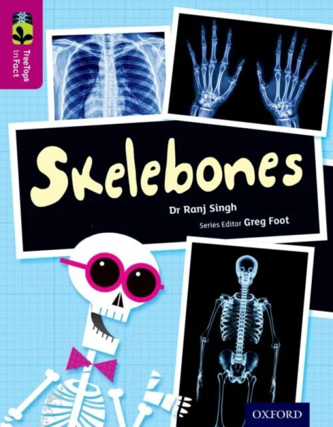 Oxford Reading Tree TreeTops inFact: Level 10: Skelebones av Ranj Singh