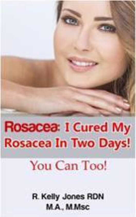 Rosacea: I Cured My Rosacea In Two Days! You Can Too!