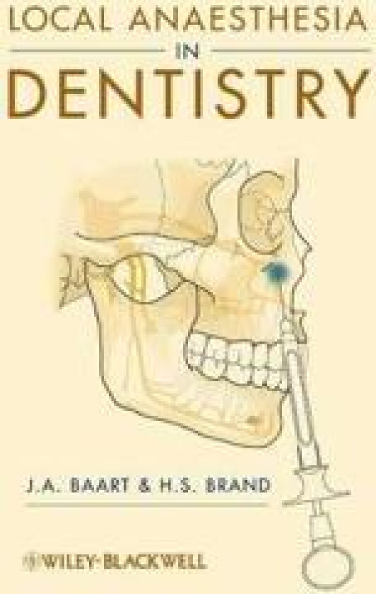 Local Anaesthesia in Dentistry