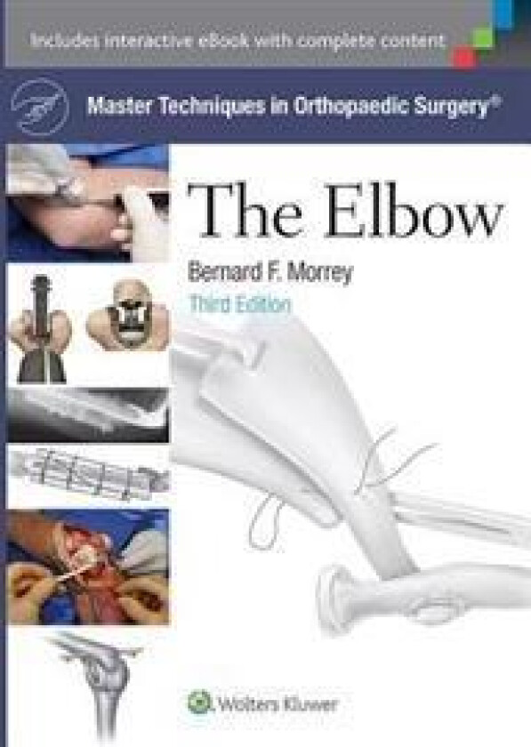 Master Techniques in Orthopaedic Surgery: The Elbow