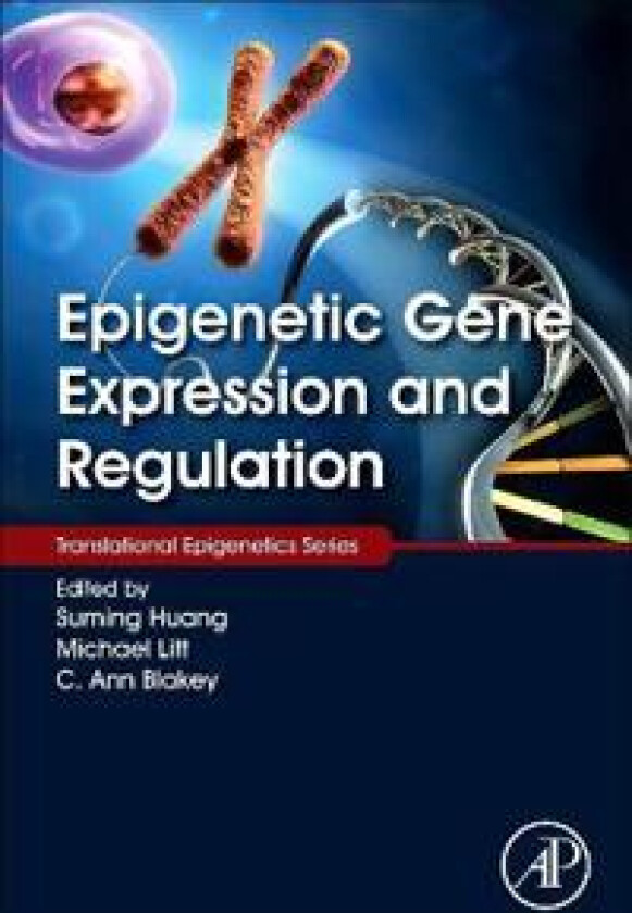 Epigenetic Gene Expression and Regulation