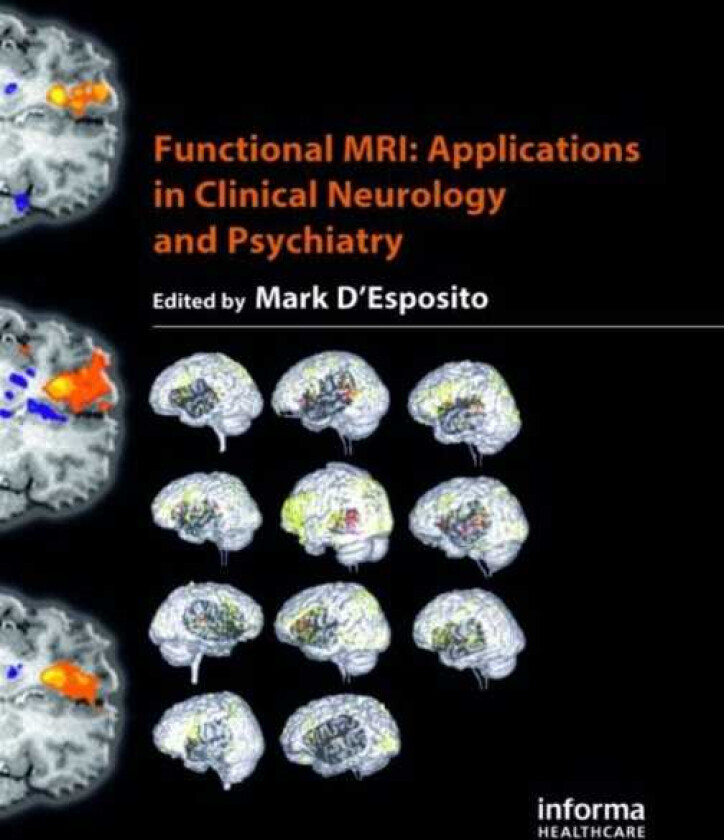 Functional MRI Applications in Clinical Neurology and Psychiatry
