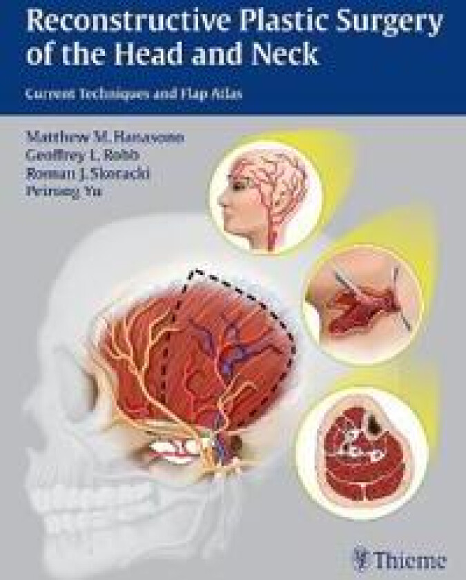 Reconstructive Plastic Surgery of the Head and Neck