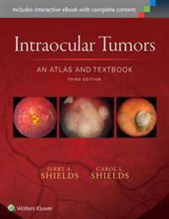 Bilde av Intraocular Tumors: An Atlas and Textbook