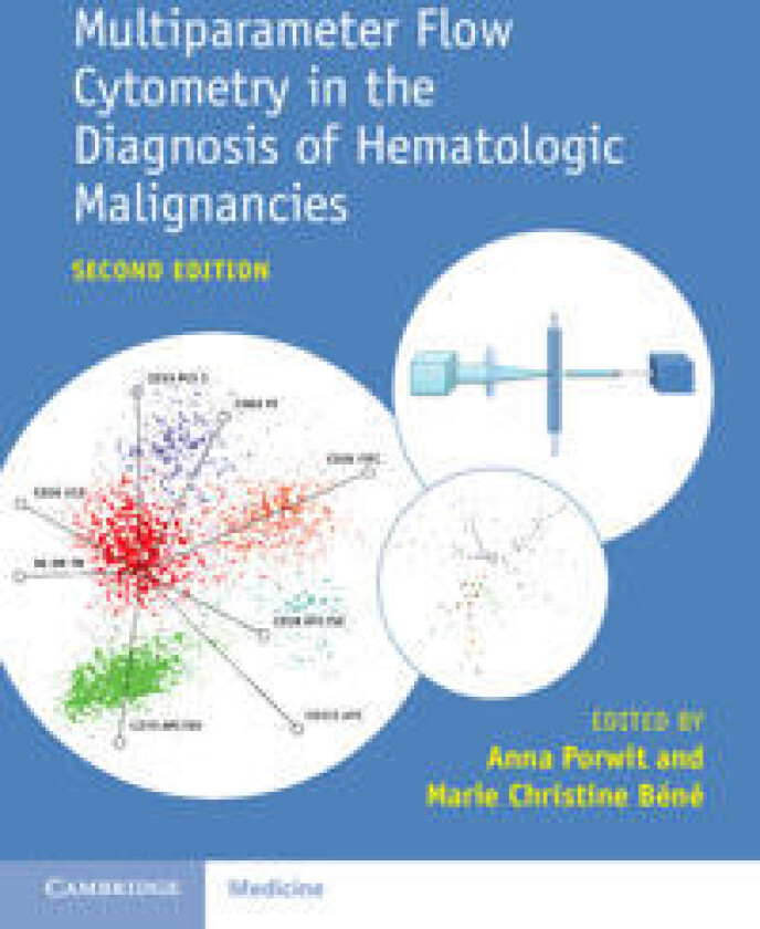 Multiparameter Flow Cytometry in the Diagnosis of Hematologic Malignancies