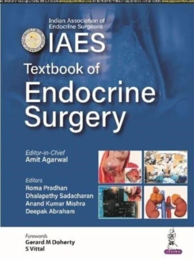 Textbook of Endocrine Surgery av Amit Agarwal, Roma Pradhan, Anand Kumar Mishra, Dhalapathy Sadacharan, Deepak Abraham