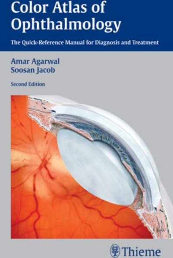 Color Atlas of Ophthalmology The QuickReference Manual for Diagnosis and Treatment