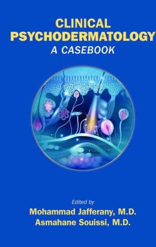 Clinical Psychodermatology A Casebook