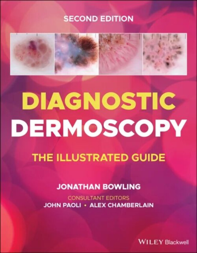 Diagnostic Dermoscopy