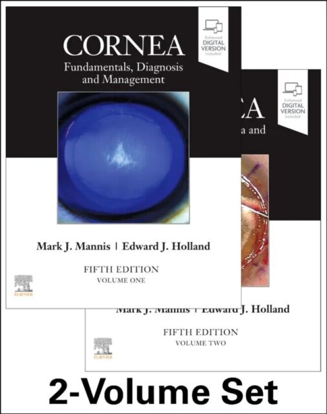 Bilde av Cornea, 2-Volume Set av Mark J MD FACS (Professor and Chair Department of Ophthalmology and Vision Science UC Davis Health System Eye Center Universit