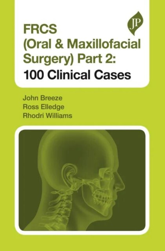 FRCS (Oral & Maxillofacial Surgery) Part 2: 100 Clinical Cases av John Breeze, Ross Elledge, Rhodri Williams