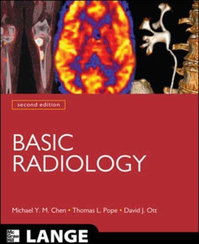 Basic Radiology, Second Edition
