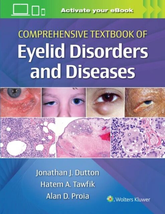 Comprehensive Textbook of Eyelid Disorders and Diseases av Jonathan MD PhD Dutton, Alan Proia, Hatem Tawfik