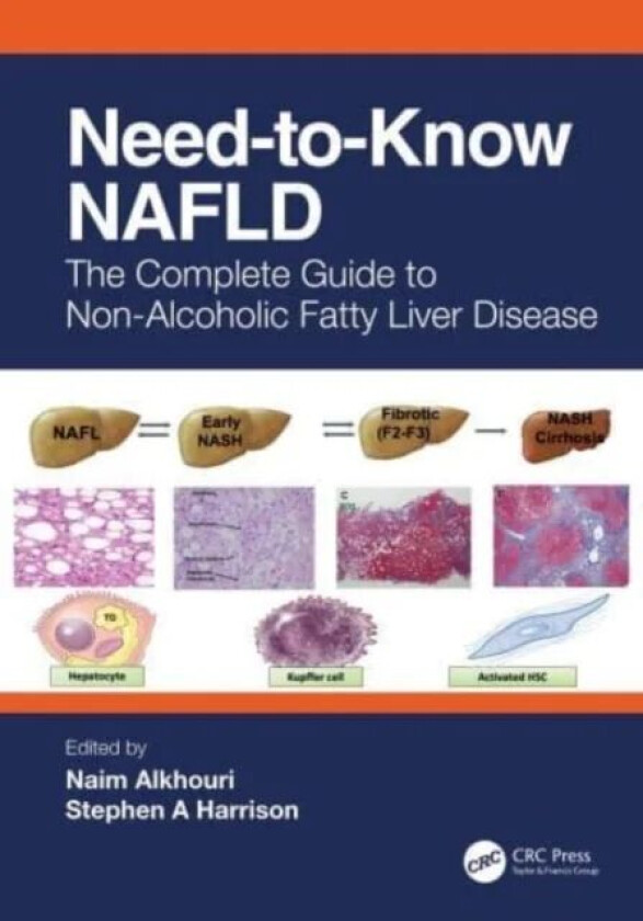Need-to-Know NAFLD