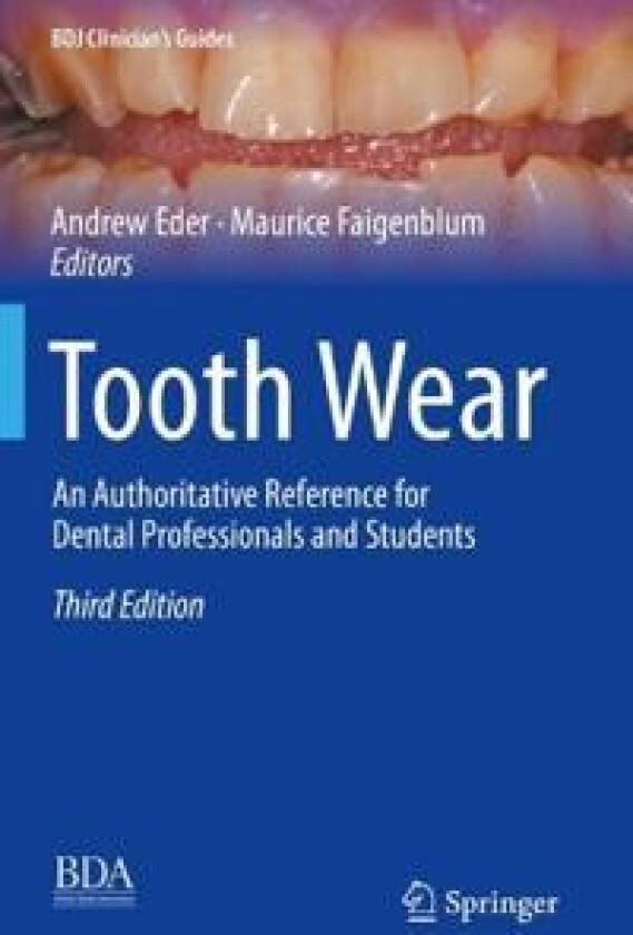 Tooth Wear
