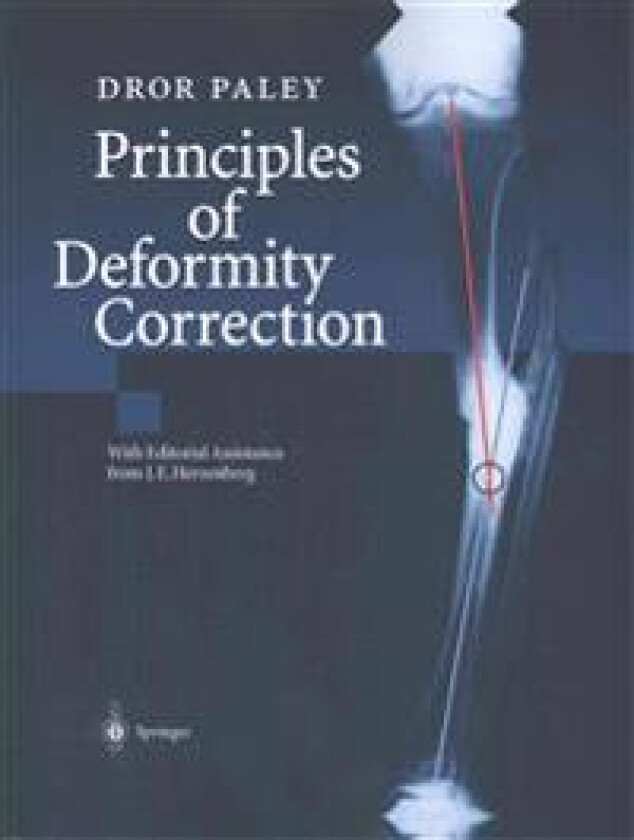 Principles of Deformity Correction