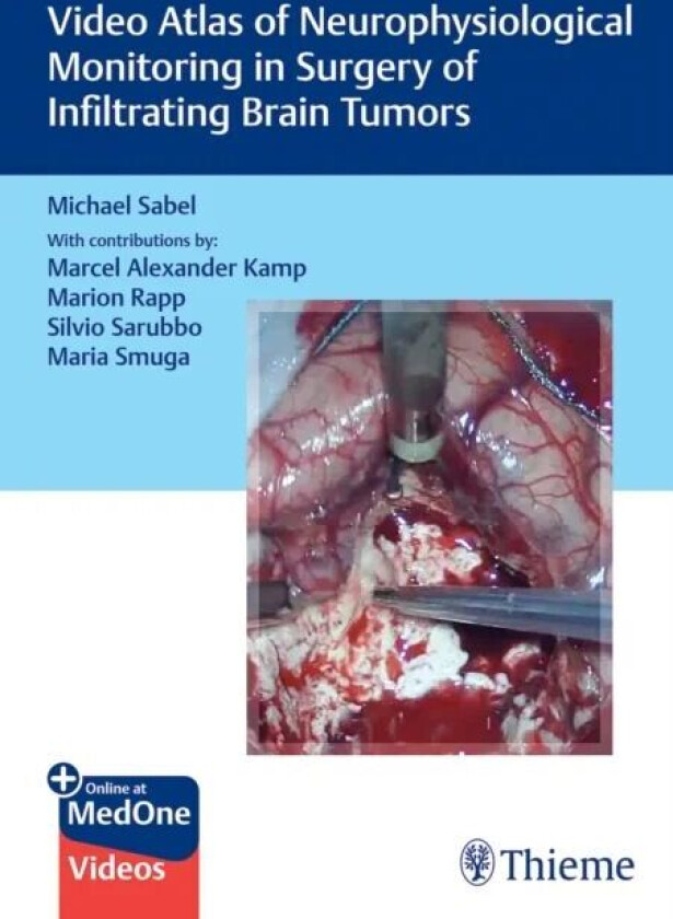 Video Atlas of Neurophysiological Monitoring in Surgery of Infiltrating Brain Tumors av Michael Christoph Sabel
