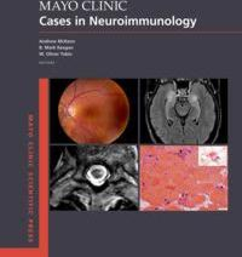 Mayo Clinic Cases in Neuroimmunology