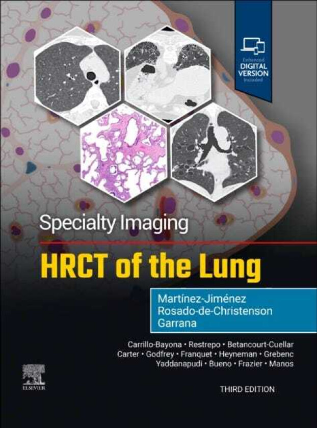 Specialty Imaging: HRCT of the Lung