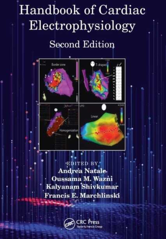 Handbook of Cardiac Electrophysiology