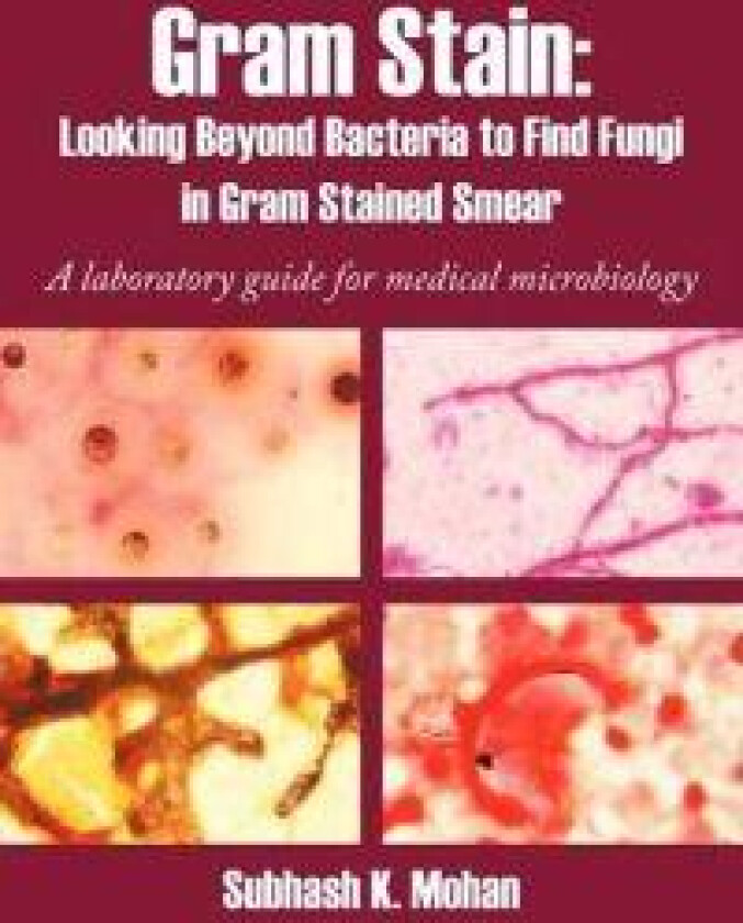 Gram Stain