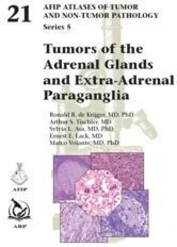 Tumors of the Adrenal Glands and Extra-Adrenal Paraganglia