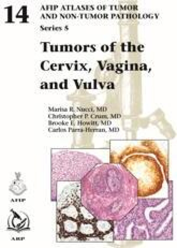 Tumors of the Cervix, Vagina, and Vulva