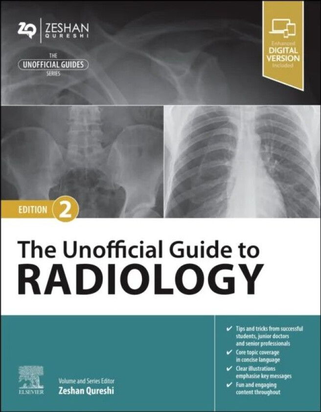 The Unofficial Guide to Radiology av Zeshan BM BSc(Hons) MSc BM MRCPCH FAcadMEd MRCPS(Glasg) (Paediatric Registrar London Deanery United Kingdom) Qure