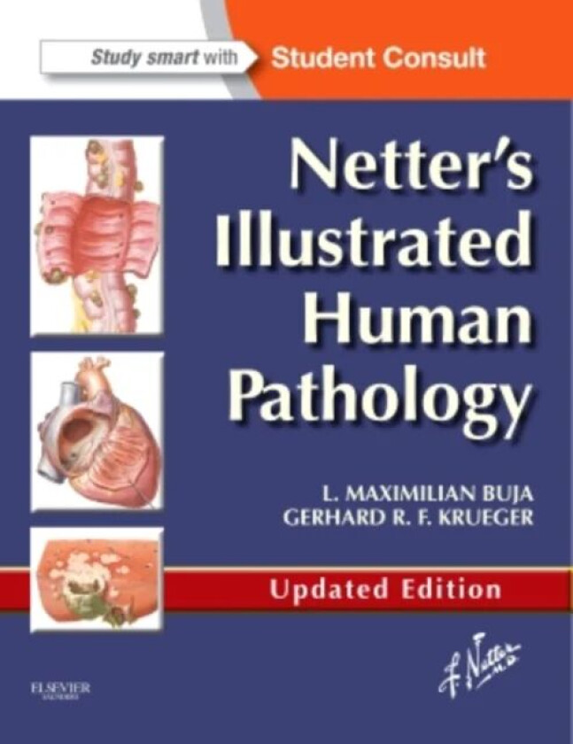 Netter's Illustrated Human Pathology Updated Edition av L. Maximilian M.D. (Professor of Pathology and Laboratory Medicine at the University of T