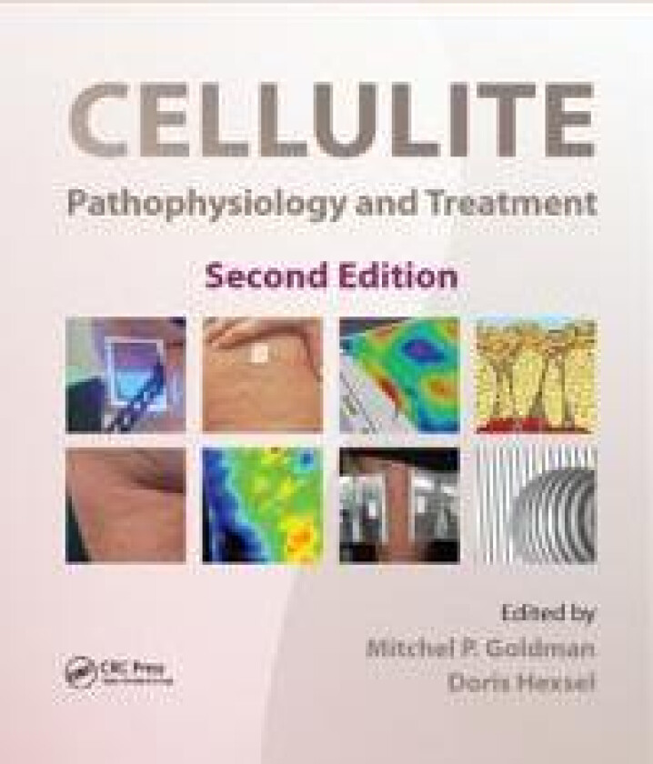 Cellulite
