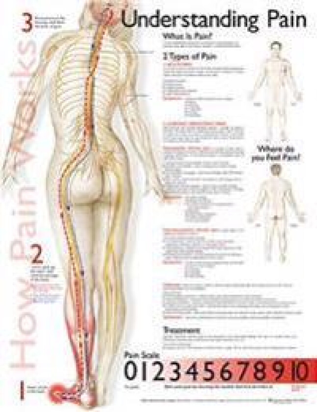 Understanding Pain Anatomical Chart