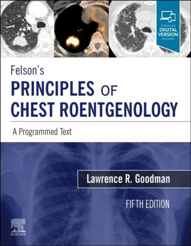 Felson's Principles of Chest Roentgenology, A Programmed Text av Lawrence R. (Professor Diagnostic Radiology and Pulmonary Medicine & Critica