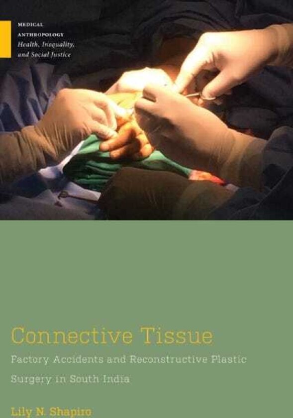 Connective Tissue Factory Accidents and Reconstructive Plastic Surgery in South India