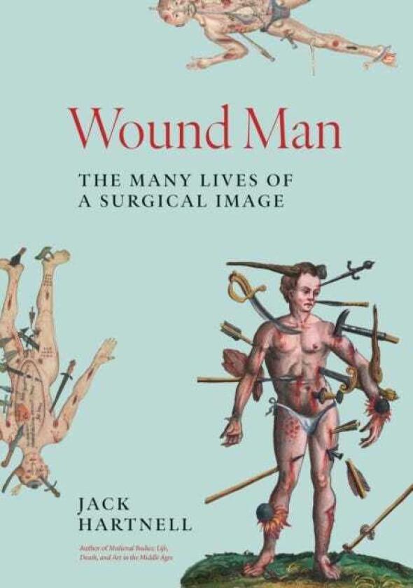 Wound Man The Many Lives of a Surgical Image