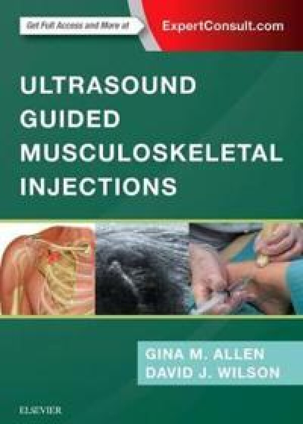 Ultrasound Guided Musculoskeletal Injections