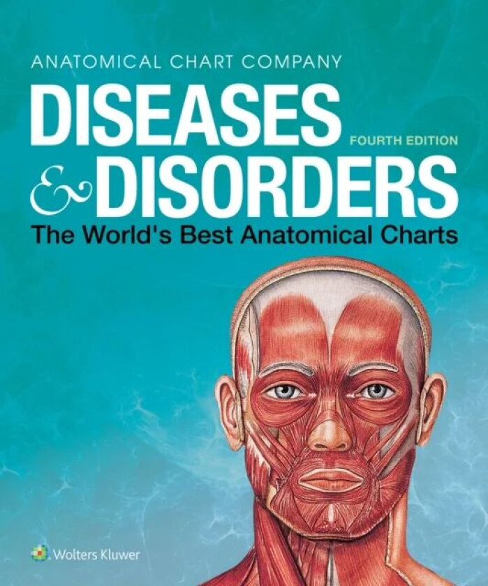 Diseases & Disorders av Anatomical Chart Company