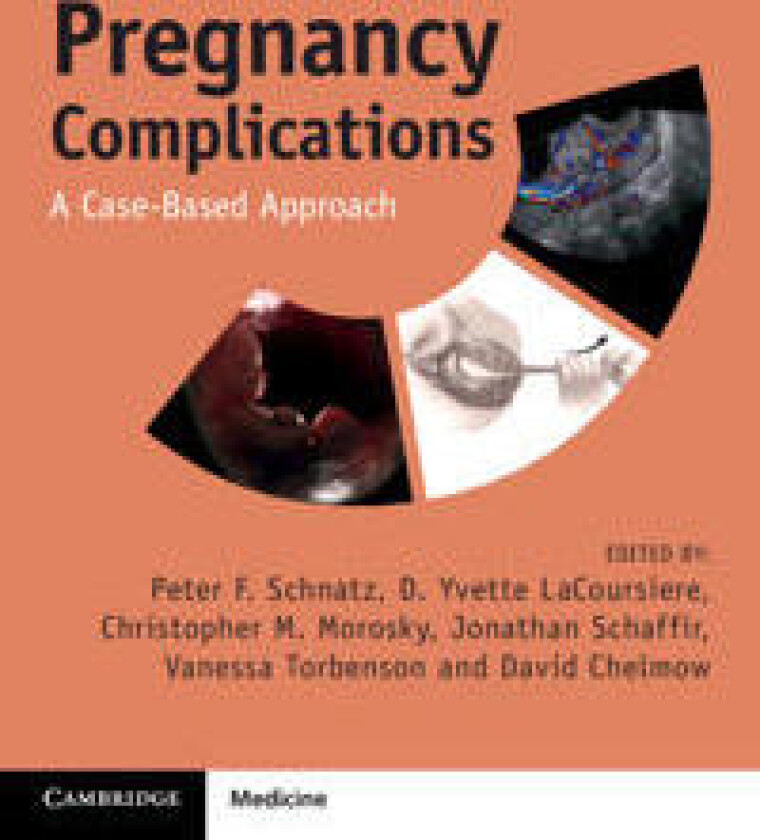 Pregnancy Complications