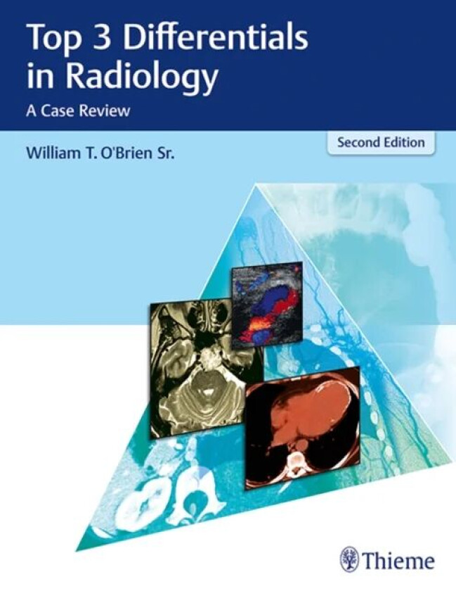 Top 3 Differentials in Radiology av William T. O'Brien