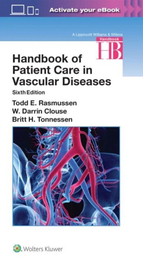 Handbook of Patient Care in Vascular Diseases av Todd Rasmussen, W. Darrin Clouse, Britt H. Tonnessen