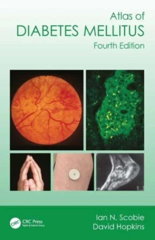 Atlas of Diabetes Mellitus av Ian N. (Medway Maritime Hospital Gillingham UK) Scobie, David (University of Glasgow UK) Hopkins