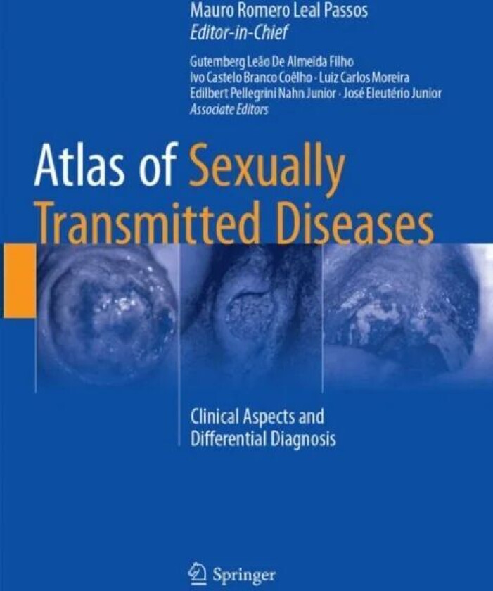 Atlas of Sexually Transmitted Diseases