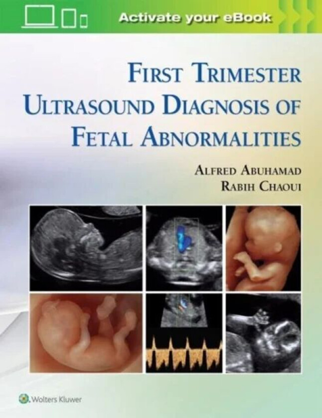 First Trimester Ultrasound Diagnosis of Fetal Abnormalities av Alfred Z. Abuhamad, Rabih Chaoui