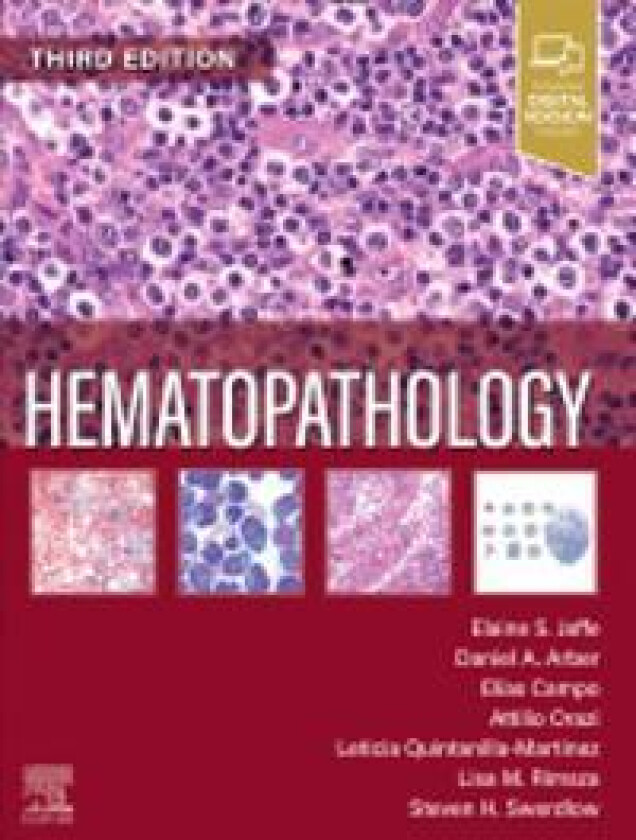 Bilde av Hematopathology