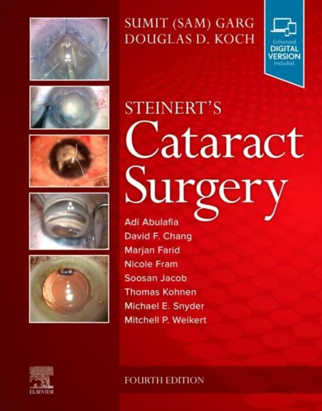 Bilde av Steinert&#039;s Cataract Surgery av Sumit MD (Vice Chair of Clinical Ophthalmology&lt;br&gt;Medical Director&lt;br&gt;Professor - Cataract Corneal and