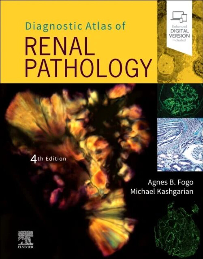 Diagnostic Atlas of Renal Pathology av Agnes B. (Professor of Pathology Medicine and Pediatrics Director Renal Electron Microscopy laboratory Vanderbi