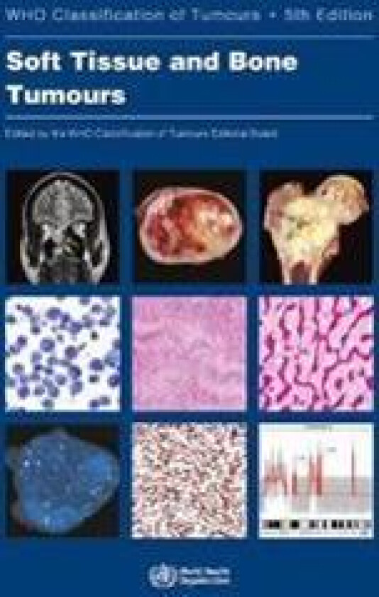 WHO classification of tumours of soft tissue and bone tumours