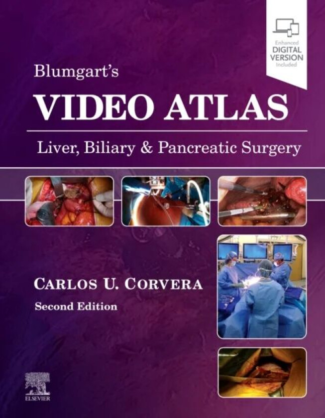 Video Atlas: Liver, Biliary & Pancreatic Surgery av Carlos (Professor of Surgery Chief of Hepatobiliary and Pancreatic Surgery Maurice Galante Dis