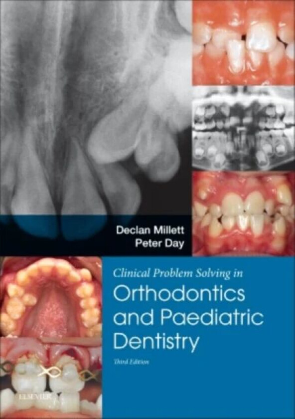Clinical Problem Solving in Dentistry: Orthodontics and Paediatric Dentistry av Declan BDSc DDS FDSRCPS FDSRCS DOrthRCSEng MOrthRCSEng (Professor of O