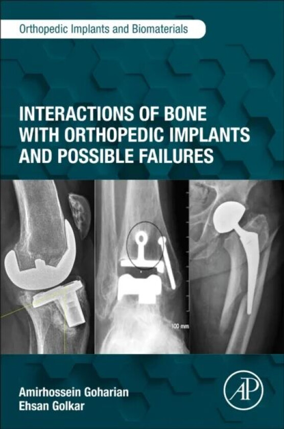 Interactions of Bone with Orthopedic Implants and Possible Failures av Amirhossein (Independent Engineering Consultant in Orthopaedic Implant and Biom
