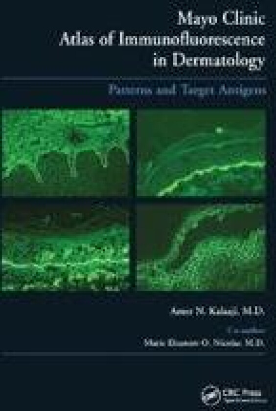 Mayo Clinic Atlas of Immunofluorescence in Dermatology
